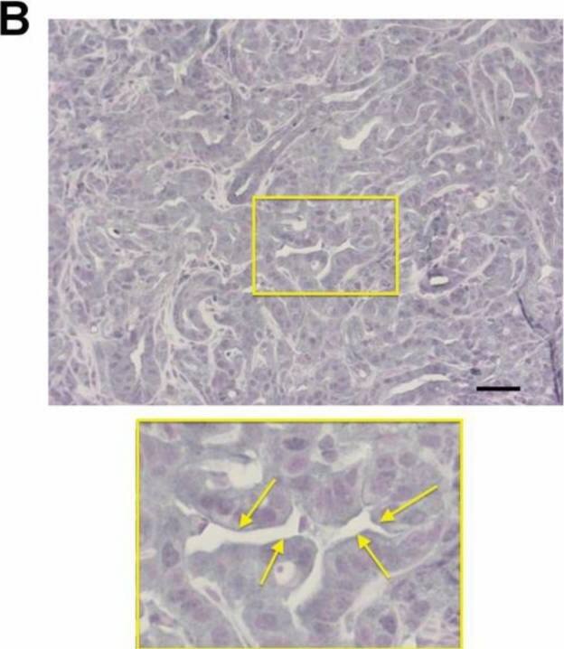 Detection of Mouse AGER by Immunohistochemistry