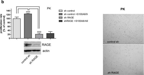 Detection of Human AGER by Western Blot