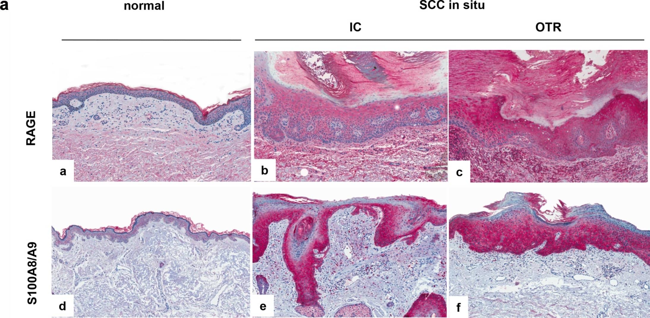 Detection of Human AGER by Immunohistochemistry
