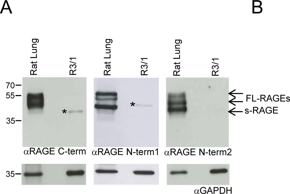 Detection of Rat AGER by Western Blot