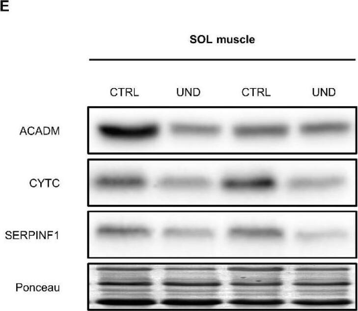 Detection of Serpin F1/PEDF by Western Blot