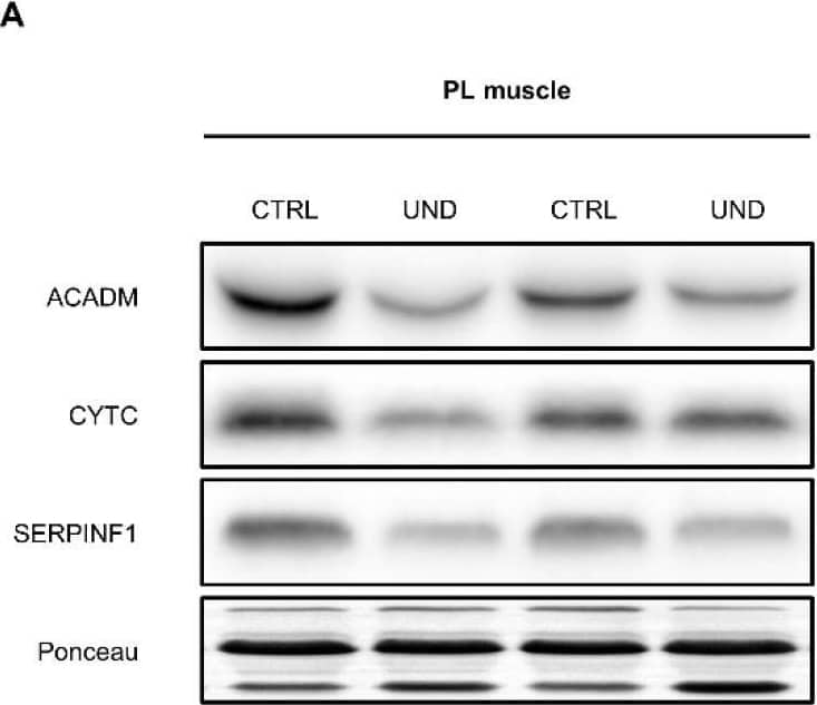 Detection of Serpin F1/PEDF by Western Blot