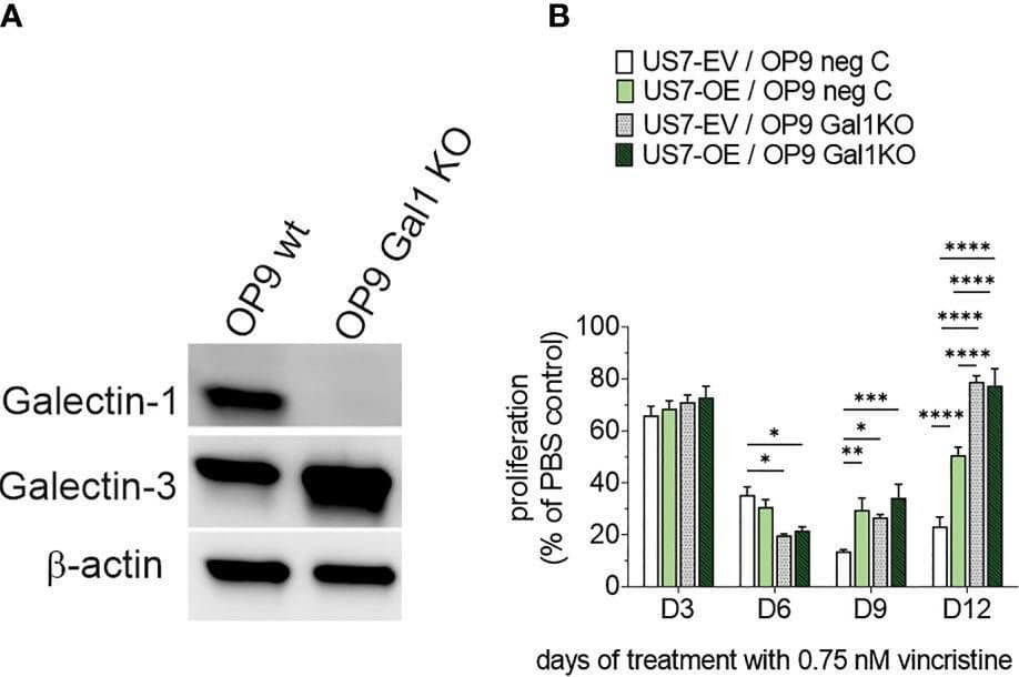 Detection of Galectin-1 by Western Blot