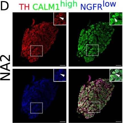 Detection of Mouse NGFR/TNFRSF16 by Immunohistochemistry
