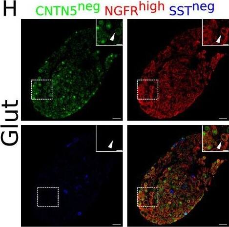 Detection of Mouse NGFR/TNFRSF16 by Immunohistochemistry