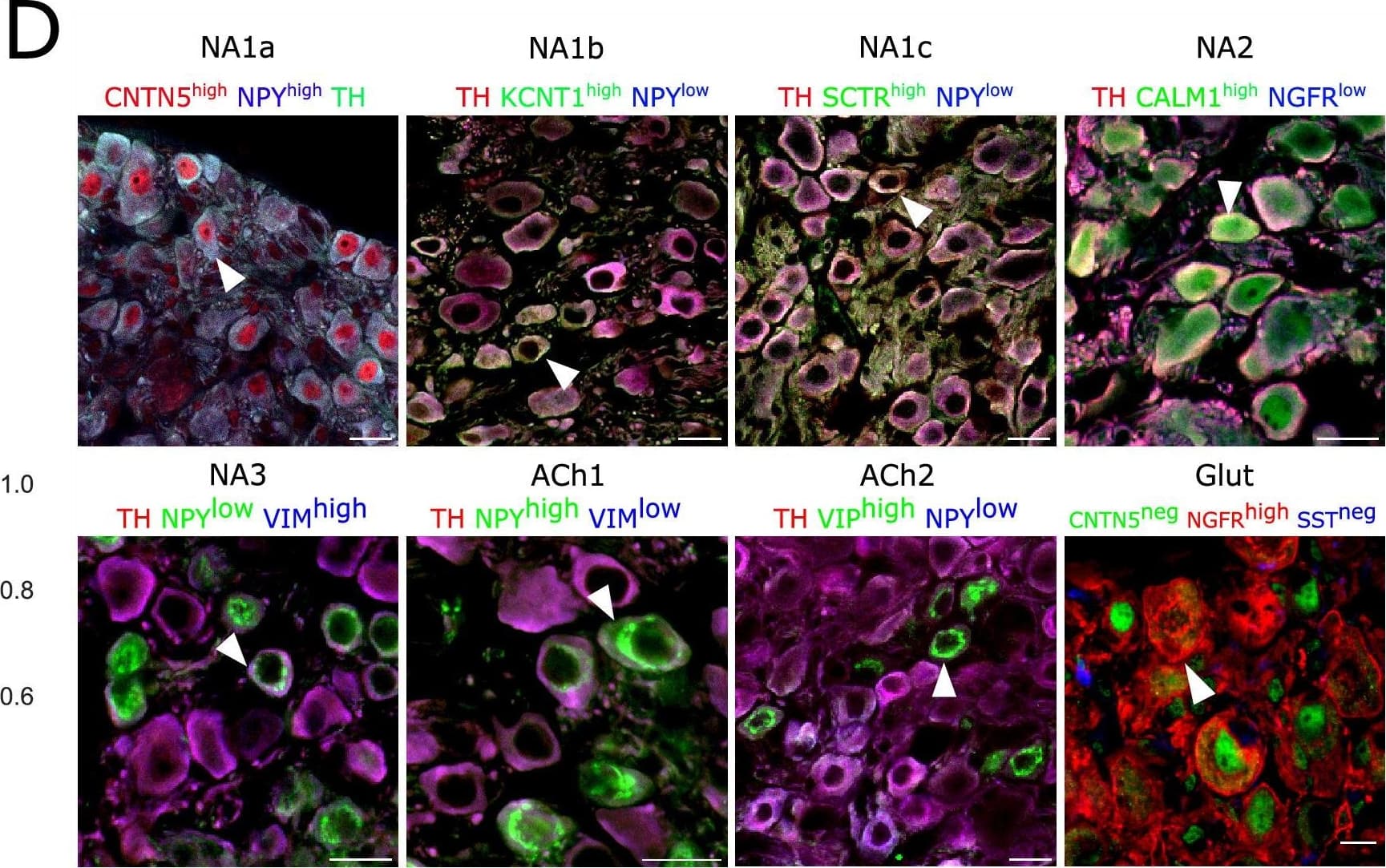 Detection of Mouse NGFR/TNFRSF16 by Immunohistochemistry