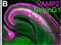 Detection of Mouse Netrin-G1a by Immunocytochemistry/ Immunofluorescence