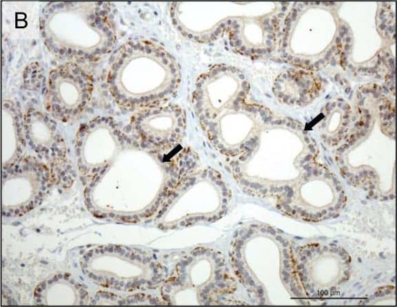 Detection of Canine Prolactin R by Immunohistochemistry