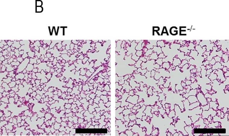 Detection of Mouse AGER by Immunohistochemistry