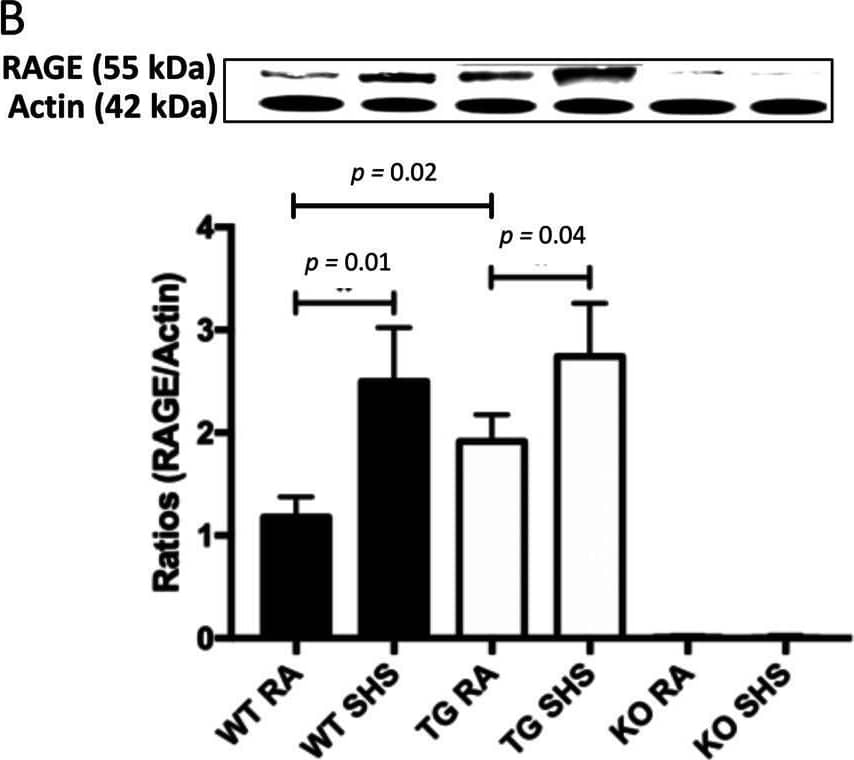 Detection of RAGE by Western Blot