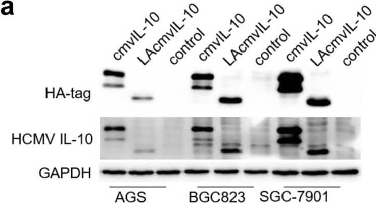 Detection of Viral HCMV IL-10 by Western Blot