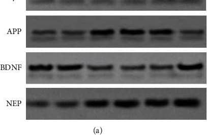 Detection of Mouse Neprilysin/CD10 by Western Blot