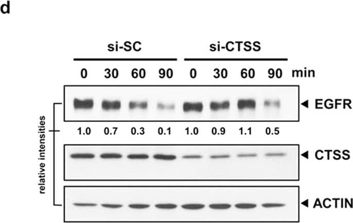 Detection of Human Cathepsin S by Western Blot