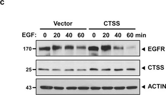 Detection of Cathepsin S by Western Blot