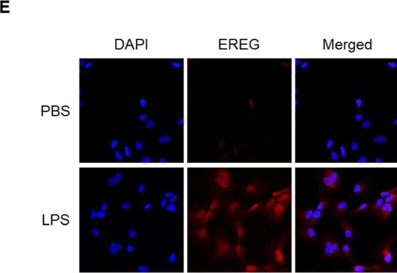 Detection of Epiregulin by Immunocytochemistry/ Immunofluorescence