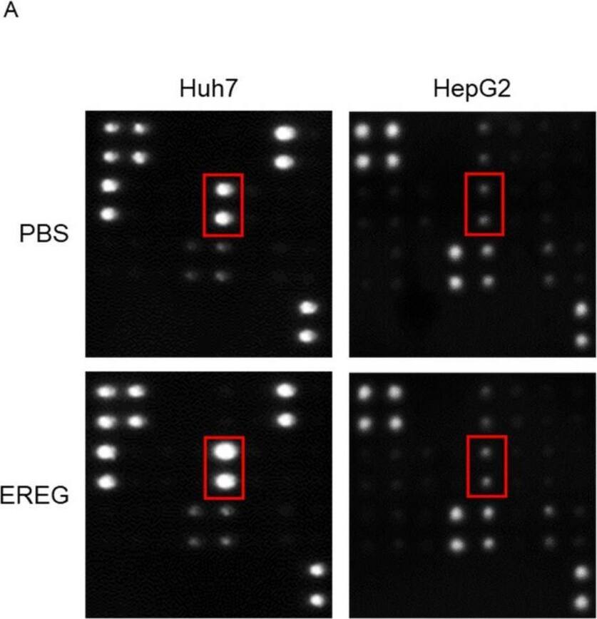 Detection of Epiregulin by Immunocytochemistry/ Immunofluorescence