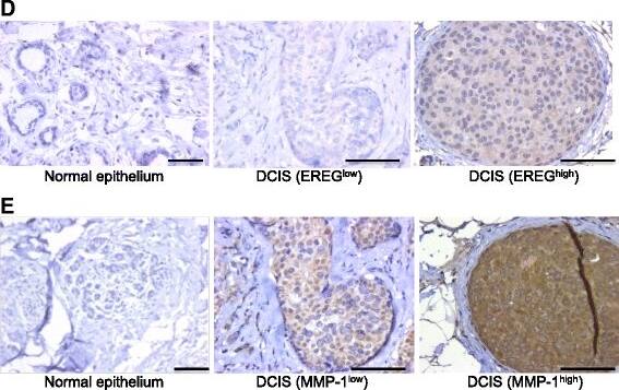 Detection of Human Epiregulin by Immunohistochemistry