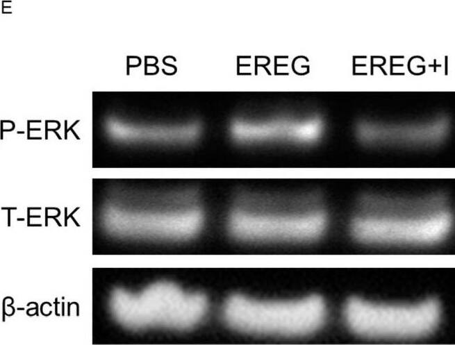 Detection of Epiregulin by Western Blot