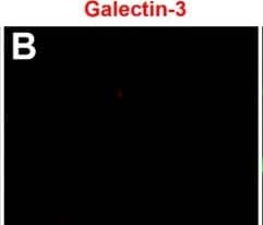 Detection of Galectin-3 by Immunocytochemistry/ Immunofluorescence
