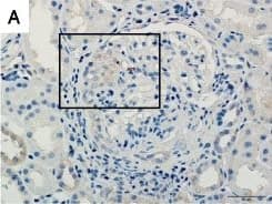 Detection of Human TWEAK R/TNFRSF12 by Immunohistochemistry-Paraffin