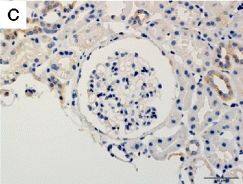 Detection of Human TWEAK R/TNFRSF12 by Immunohistochemistry-Paraffin