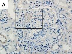 Detection of Human TWEAK R/TNFRSF12 by Immunohistochemistry-Paraffin