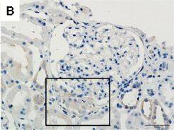 Detection of Human TWEAK R/TNFRSF12 by Immunohistochemistry-Paraffin
