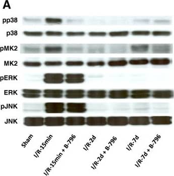 Detection of Mouse JNK1/2/3 by Western Blot