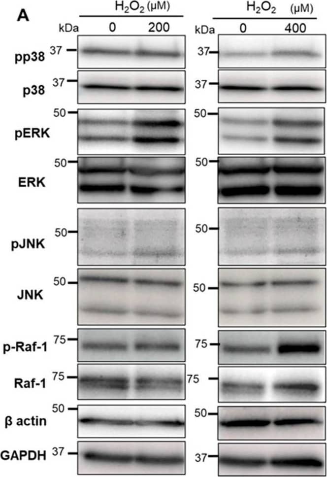 Detection of Rat Phospho-JNK (T183/Y185) by Western Blot
