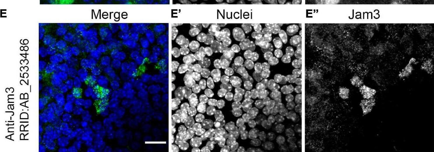 Detection of JAM-C by Immunohistochemistry