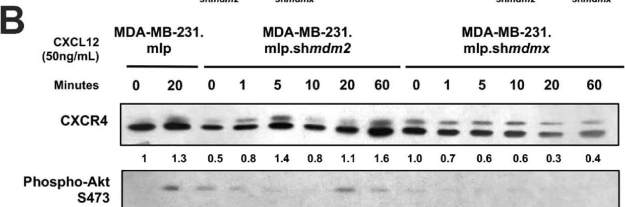 Detection of MDM2/HDM2 by Western Blot