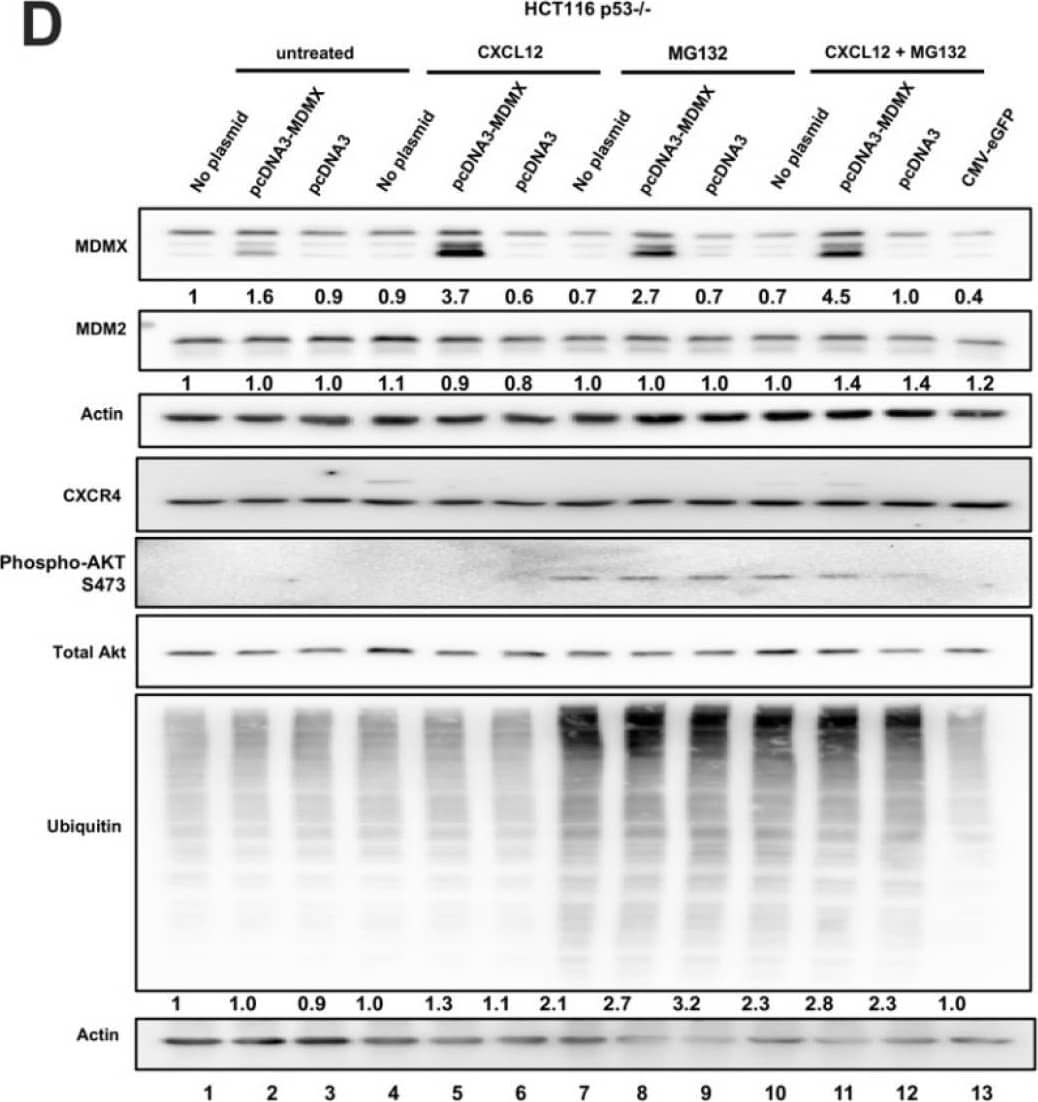 Detection of MDM2/HDM2 by Western Blot