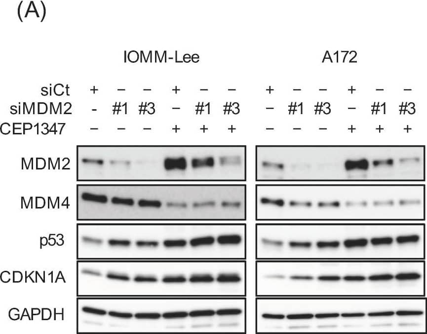 Detection of MDM2/HDM2 by Western Blot
