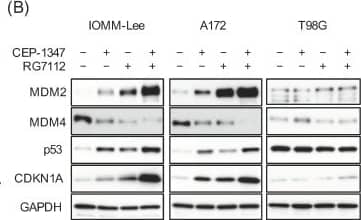 Detection of MDM2/HDM2 by Western Blot