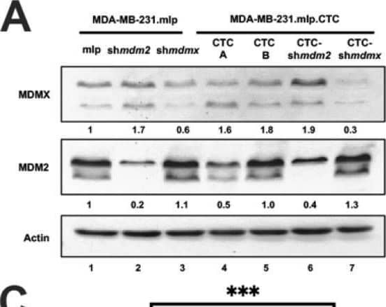 Detection of MDM2/HDM2 by Western Blot
