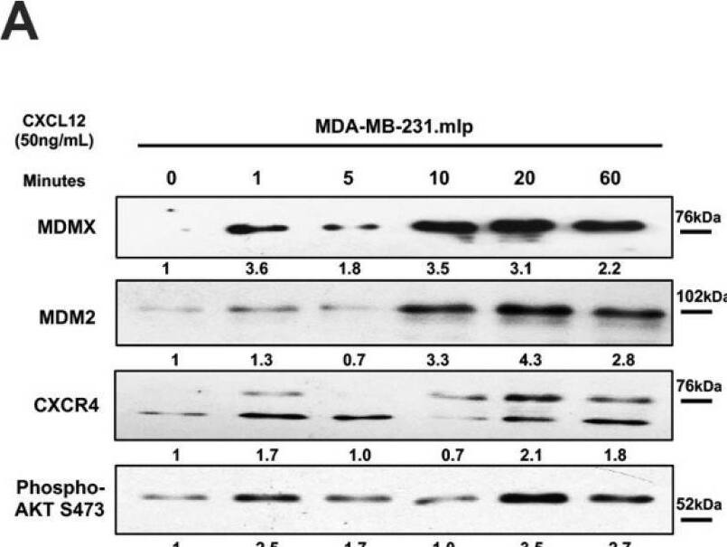 Detection of MDM2/HDM2 by Western Blot