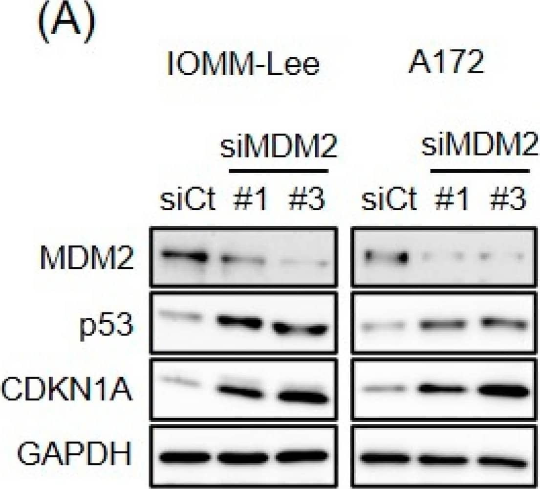 Detection of MDM2/HDM2 by Western Blot