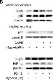 Detection of Human BAFF/BLyS/TNFSF13B by Western Blot