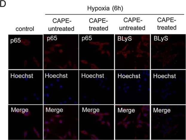 Detection of Human BAFF/BLyS/TNFSF13B by Immunocytochemistry/ Immunofluorescence