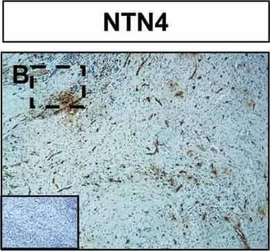 Detection of Human Netrin-4 by Immunohistochemistry