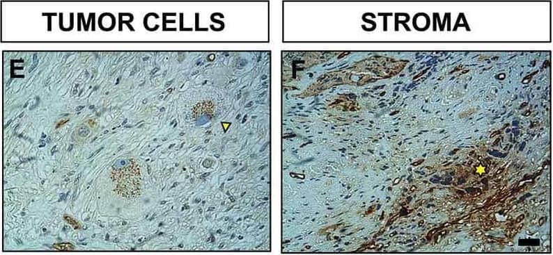 Detection of Human Netrin-4 by Immunohistochemistry