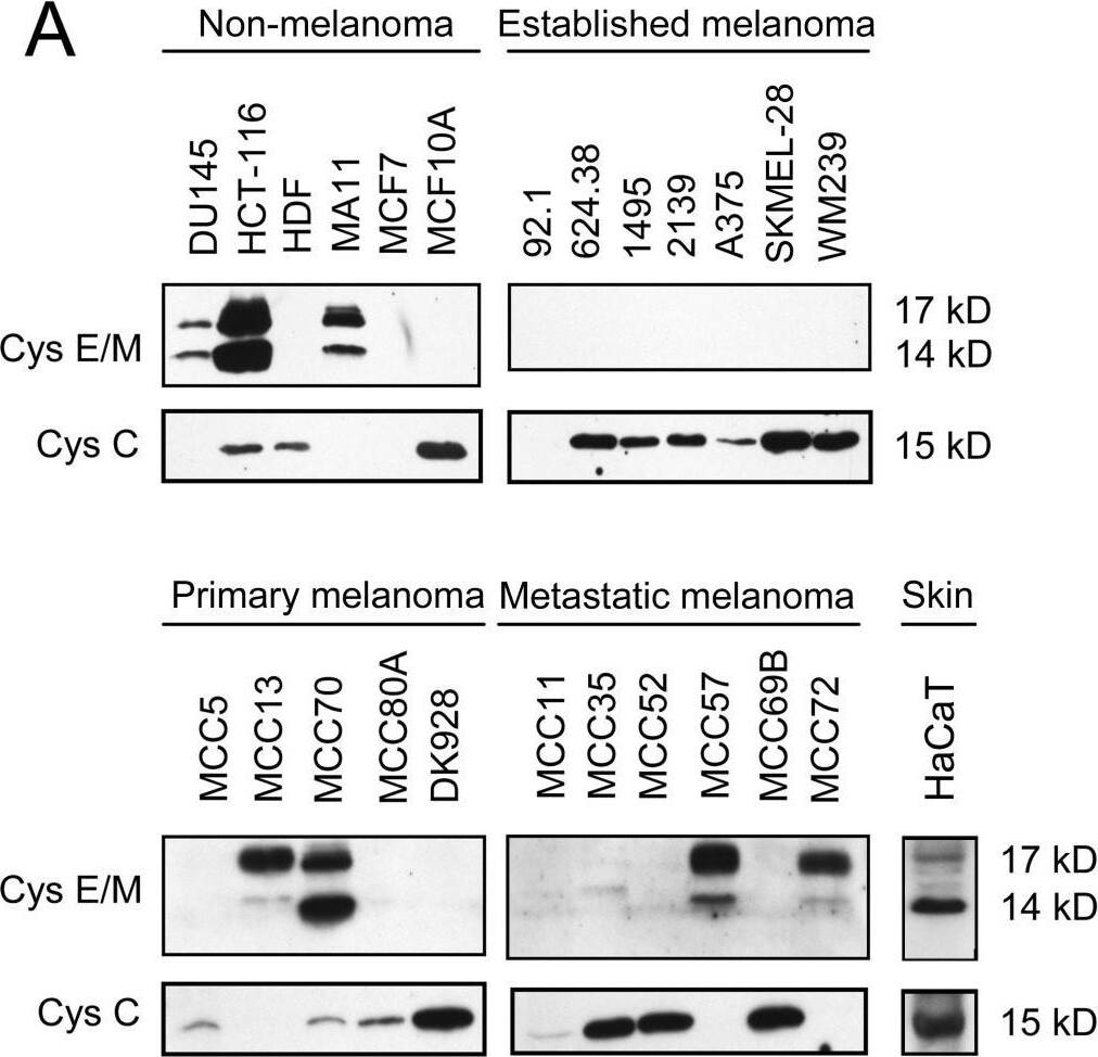 Detection of Human Cystatin E/M/CST6 by Western Blot