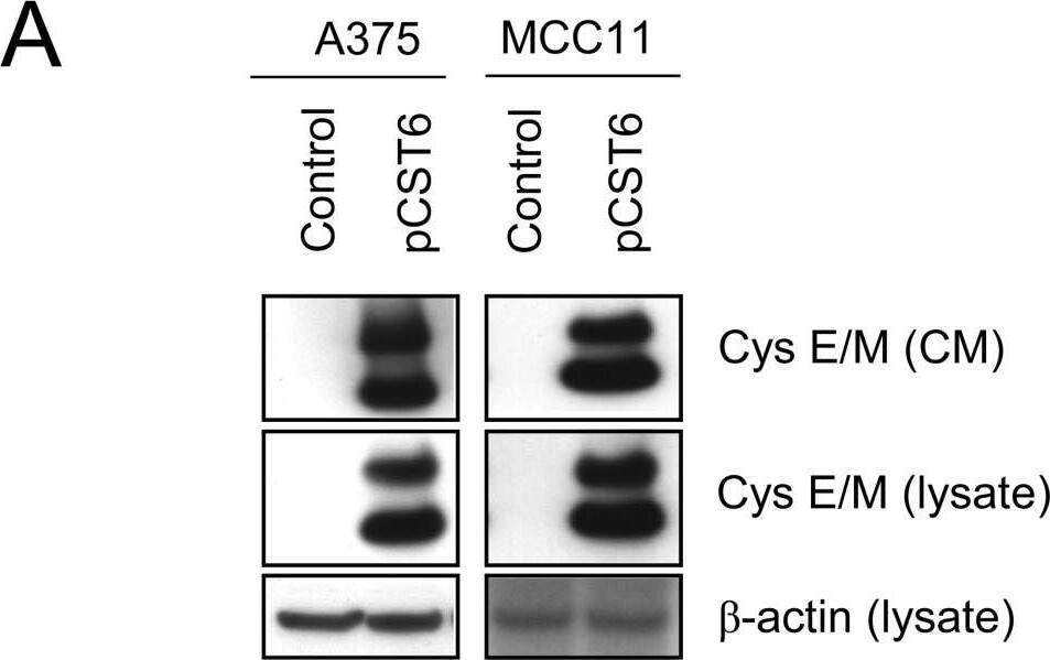 Detection of Cystatin E/M/CST6 by Western Blot