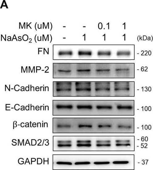 Detection of Human beta-Catenin by Western Blot