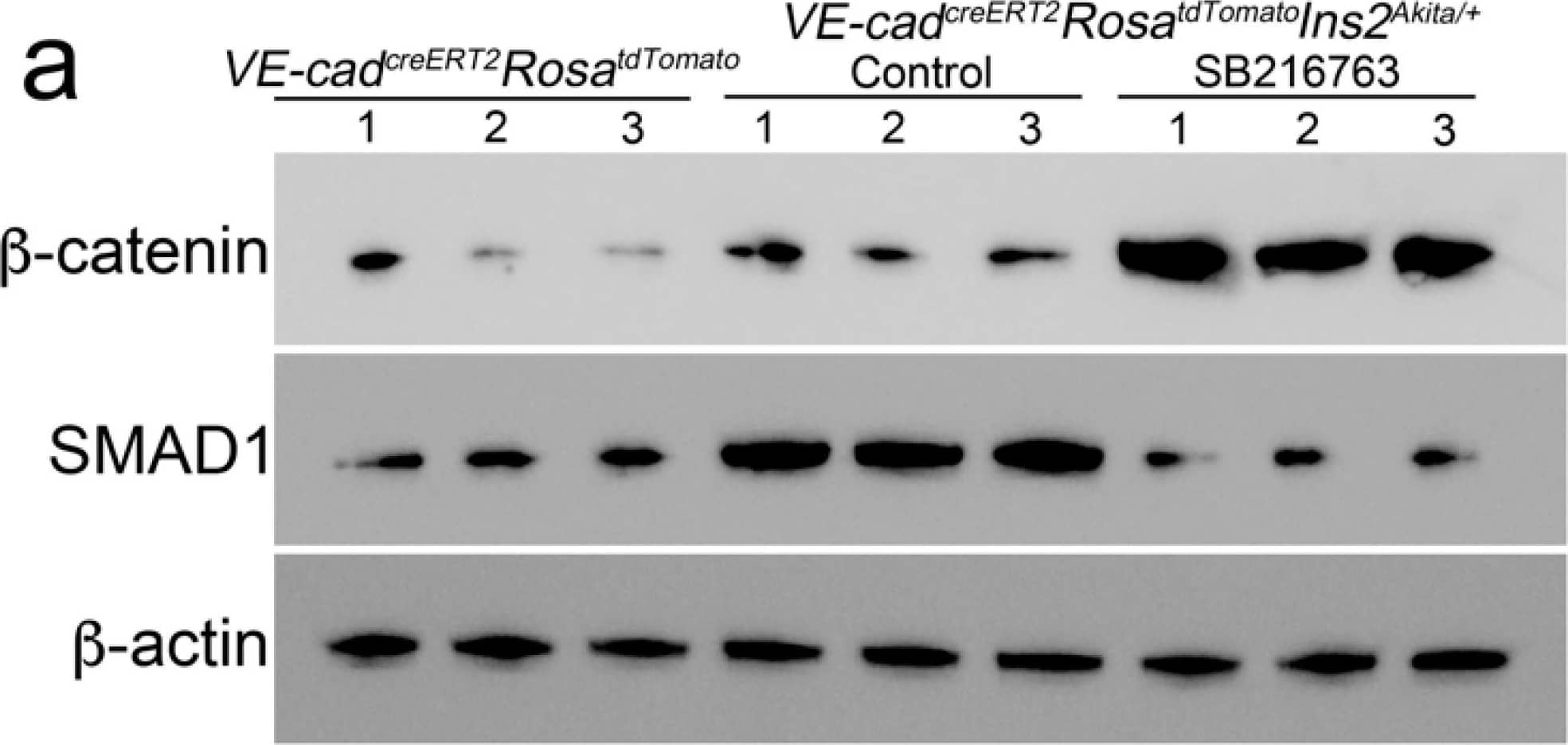 Detection of beta-Catenin by Western Blot