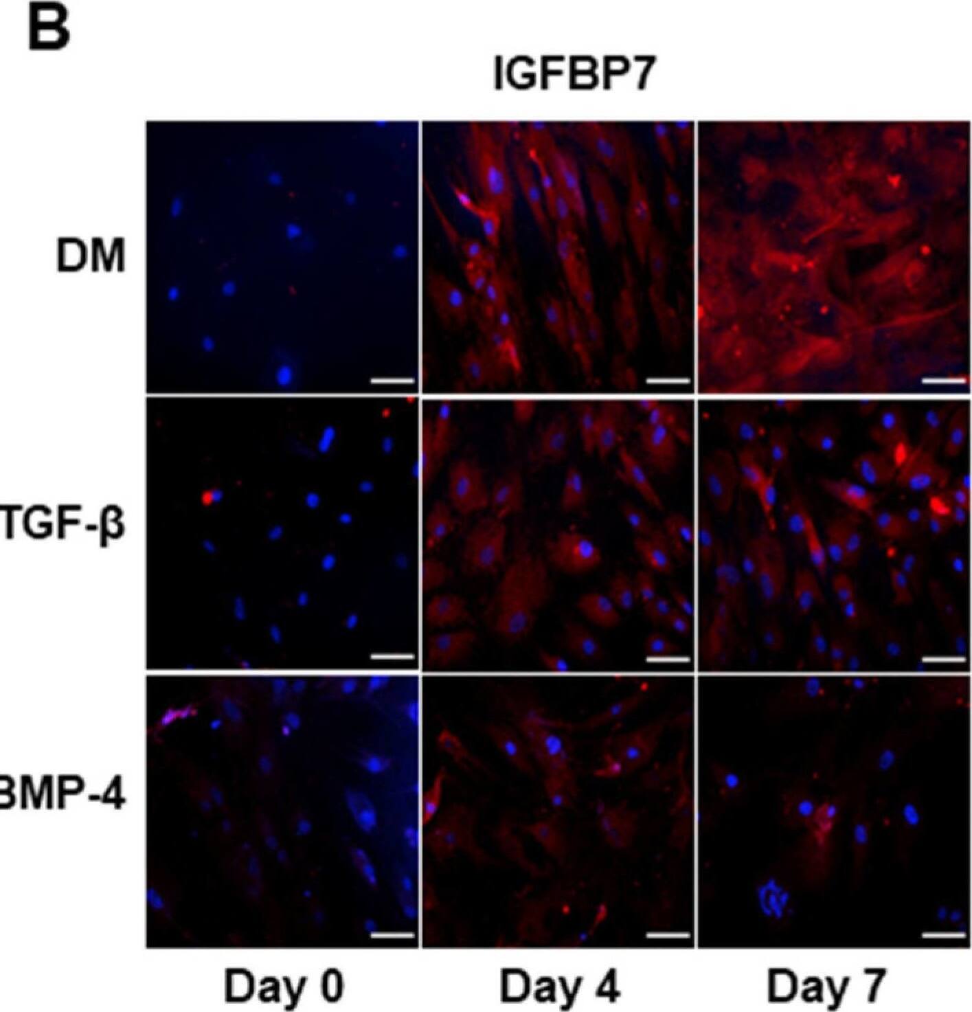 Detection of IGFBP-rp1/IGFBP-7 by Immunocytochemistry/ Immunofluorescence
