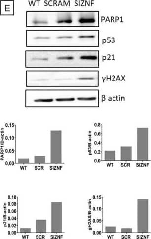 Detection of p53 by Western Blot