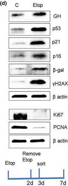 Detection of p53 by Western Blot