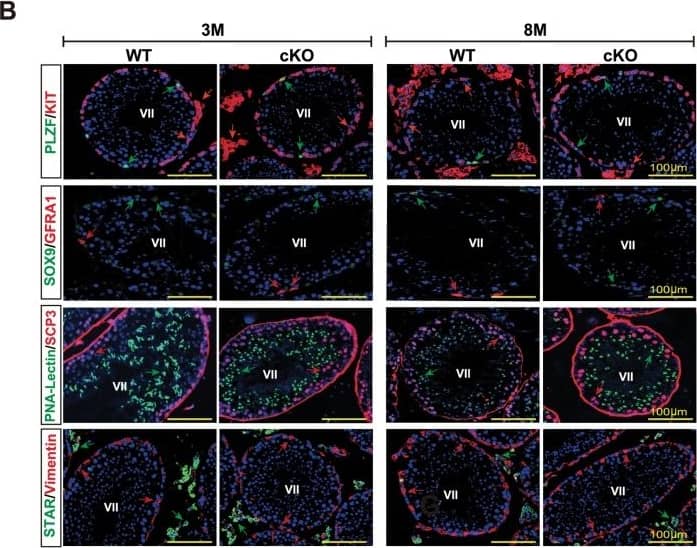 Detection of Mouse CD117/c-kit by Immunocytochemistry/Immunofluorescence