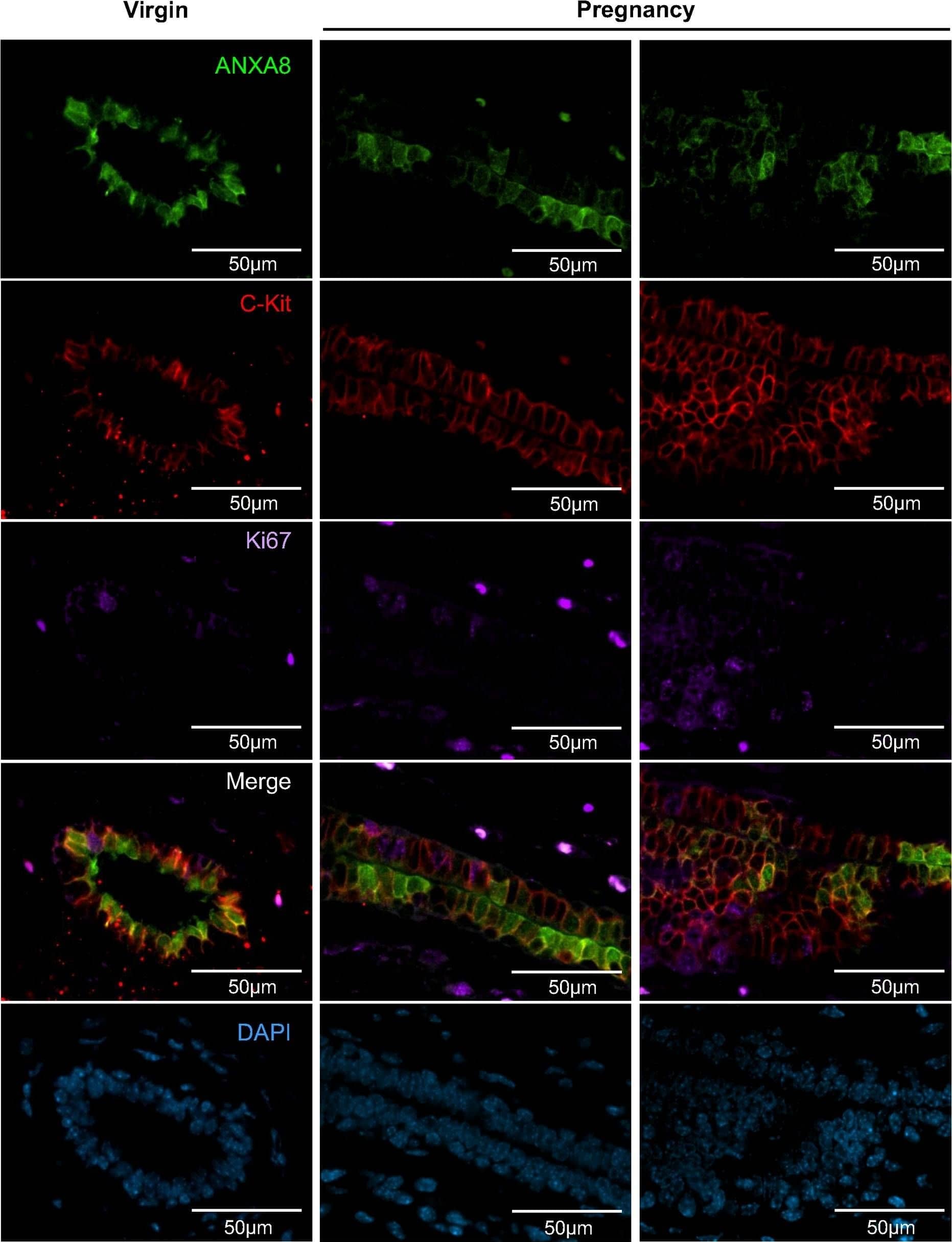 Detection of Mouse CD117/c-kit by Immunocytochemistry/Immunofluorescence
